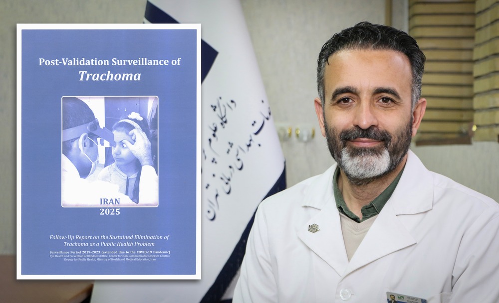 تدوین اولین گزارش «مراقبت پس از مهار تراخم» در جهان